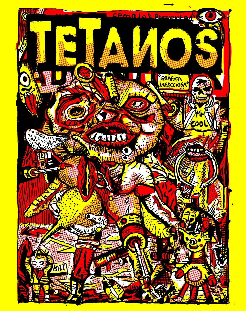 Tetanos